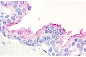 Image no. 1 for anti-G Protein-Coupled Receptor 21 (GPR21) (Cytoplasmic Domain) antibody (ABIN1048777) (GPR21 antibody  (Cytoplasmic Domain))
