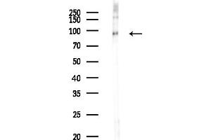 anti-Ubiquitin Specific Peptidase 16 (USP16) (N-Term) antibody