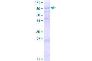 Image no. 1 for Calicin (CCIN) (AA 1-588) protein (GST tag) (ABIN1348354)