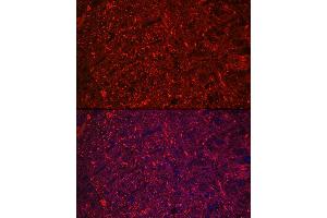Immunofluorescence analysis of rat brain using Neurofilament L Rabbit mAb (ABIN7268867) at dilution of 1:100 (40x lens). (NEFL antibody)