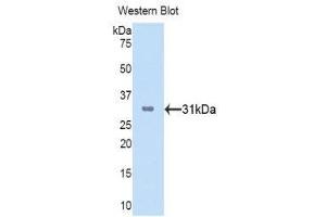 Western Blotting (WB) image for anti-Cathepsin K (CTSK) (AA 115-329) antibody (ABIN3201849) (Cathepsin K antibody  (AA 115-329))