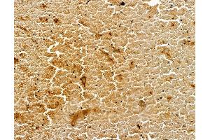 ABIN7094940 and ABIN7098996 at 1/100 staining mouse heart tissue by IHC-P.