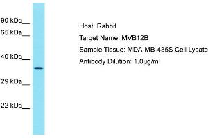 Host: Rabbit Target Name: MVB12B Sample Tissue: Human MDA-MB-435S Whole Cell Antibody Dilution: 1ug/ml (MVB12B antibody  (C-Term))