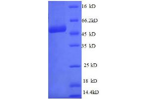 Chromosome 21 Open Reading Frame 33 (C21orf33) (AA 43-268), (full length) protein (GST tag)