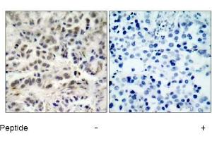 Image no. 1 for anti-Cyclin-Dependent Kinase Inhibitor 1B (p27, Kip1) (CDKN1B) (Ser10) antibody (ABIN197350) (CDKN1B antibody  (Ser10))