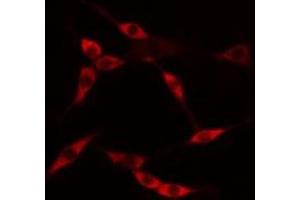 ABIN6275231 staining HuvEc cells by IF/ICC. (MAP9 antibody  (N-Term))