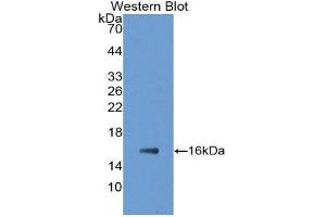 Western Blotting (WB) image for anti-Fatty Acid Binding Protein 5 (Psoriasis-Associated) (FABP5) (AA 2-135) antibody (ABIN1858784)