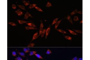 Immunofluorescence analysis of L929 cells using COL4A3 Polyclonal Antibody at dilution of 1:100. (COL4a3 antibody)
