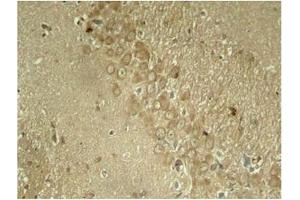 Image no. 1 for anti-Microtubule-Associated Protein tau (MAPT) (pSer262) antibody (ABIN196808) (MAPT antibody  (pSer262))