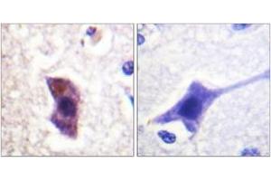 Immunohistochemistry analysis of paraffin-embedded human brain, using HRS (Phospho-Tyr334) Antibody. (HRS (HRS) (AA 301-350), (pTyr334) antibody)