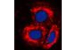 Immunofluorescent analysis of ALK1 staining in MCF7 cells. (ACVRL1 antibody  (Center))