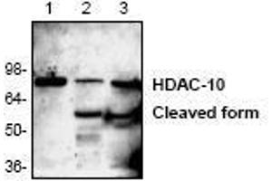 Image no. 1 for anti-Histone Deacetylase 10 (HDAC10) (N-Term) antibody (ABIN127250) (HDAC10 antibody  (N-Term))