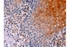Detection of Bcl2 in Human Tonsil Tissue using Polyclonal Antibody to B-Cell Leukemia/Lymphoma 2 (Bcl2) (Bcl-2 antibody  (AA 2-211))