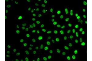 Immunofluorescence analysis of MCF-7 cells using SF3B2 antibody. (SF3B2 antibody)