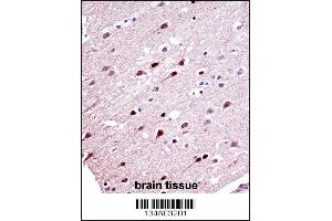 KCND2 Antibody immunohistochemistry analysis in formalin fixed and paraffin embedded human brain tissue followed by peroxidase conjugation of the secondary antibody and DAB staining.