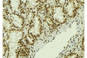 ABIN6273060 at 1/100 staining Human lung tissue by IHC-P. (NOB1 antibody  (C-Term))