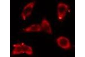 ABIN6276440 staining COLO205 cells by IF/ICC. (ARF6 antibody  (Internal Region))