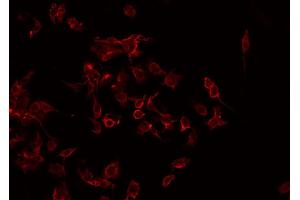 ABIN6268838 staining Hela by IF/ICC. (CMKLR1 antibody  (Internal Region))