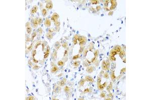 Immunohistochemistry of paraffin-embedded human stomach using TDGF1 antibody. (TDGF1 antibody)