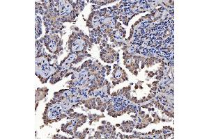 IHC analysis of SARS2 using anti-SARS2 antibody (ABIN7601804). (SARS2 antibody  (AA 46-518))