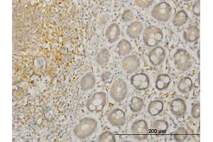 Immunoperoxidase of monoclonal antibody to LIMK1 on formalin-fixed paraffin-embedded human colon.