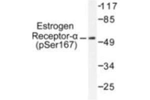 Image no. 1 for anti-Estrogen Receptor 1 (ESR1) (pSer167) antibody (ABIN318019) (Estrogen Receptor alpha antibody  (pSer167))