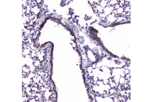 IHC analysis of PDE4D using anti-PDE4D antibody . (PDE4D antibody  (AA 466-709))