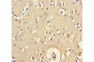 Immunohistochemistry of paraffin-embedded human brain tissue using ABIN7165132 at dilution of 1:100 (BEX5 antibody  (AA 1-111))