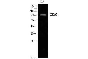 Western Blot (WB) analysis of KB cells using CD93 Polyclonal Antibody. (CD93 antibody  (Internal Region))