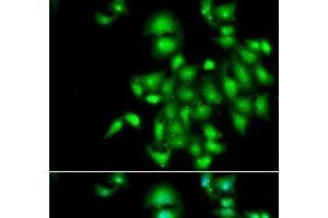 Immunofluorescence analysis of A549 cells using IL20 Polyclonal Antibody (IL-20 antibody)