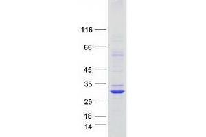 Western Blotting (WB) image for Transmembrane Protein 163 (TMEM163) protein (Myc-DYKDDDDK Tag) (ABIN2733852)
