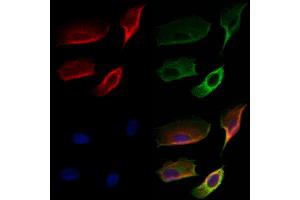 ABIN6259322 and ABIN6274776 staining Hela cells by IF/ICC. (RPL28 antibody  (C-Term))