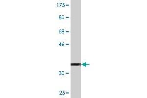 Western Blot detection against Immunogen (35. (RCBTB1 antibody  (AA 2-90))