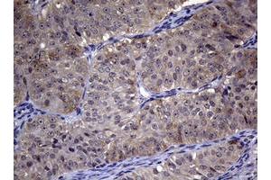 Image no. 1 for anti-Ribonucleotide Reductase M1 (RRM1) (AA 541-792) antibody (ABIN1491583) (RRM1 antibody  (AA 541-792))