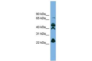 WB Suggested Anti-RPE Antibody Titration: 0. (RPE antibody  (N-Term))