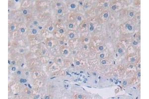 Detection of TFR2 in Human Liver Tissue using Polyclonal Antibody to Transferrin Receptor 2 (TFR2) (Transferrin Receptor 2 antibody  (AA 4-87))