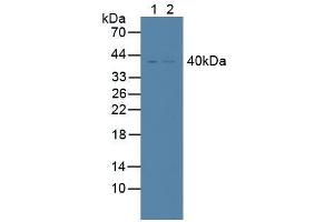 Western blot analysis of (1) Human K562 Cells and (2) Human Lung Tissue. (TNFRSF10B antibody  (AA 234-435))