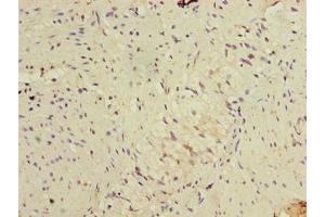 Immunohistochemistry of paraffin-embedded human colon tissue using ABIN7152486 at dilution of 1:100 (BTRC antibody  (AA 701-1000))