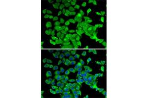 Immunofluorescence analysis of MCF7 cells using PARN antibody (ABIN6129553, ABIN6145230, ABIN6145231 and ABIN6222686). (PARN antibody  (AA 1-280))