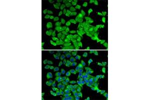 Immunofluorescence analysis of MCF7 cells using PARN antibody (ABIN6129553, ABIN6145230, ABIN6145231 and ABIN6222686). (PARN antibody  (AA 1-280))