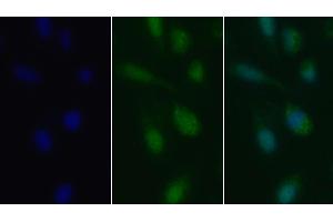 Detection of TGFb1 in Human U2OS cell using Polyclonal Antibody to Transforming Growth Factor Beta 1 (TGFb1) (TGFB1 antibody  (AA 279-390))