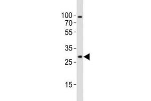 Western blot analysis of lysate from mouse brain tissue lysate using Olig1 antibody diluted at 1:1000. (OLIG1 antibody  (AA 161-184))
