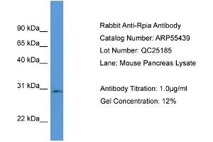 Western Blotting (WB) image for anti-Ribose 5-Phosphate Isomerase A (RPIA) (Middle Region) antibody (ABIN2786211) (Ribose 5-Phosphate Isomerase A (RPIA) (Middle Region) antibody)