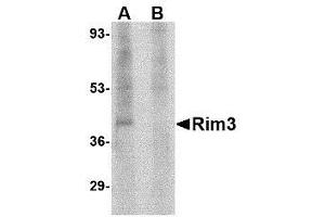 Image no. 1 for anti-Regulating Synaptic Membrane Exocytosis 3 (RIMS3) (N-Term) antibody (ABIN1495404) (RIMS3 antibody  (N-Term))
