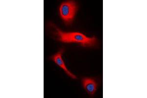 Immunofluorescent analysis of Glucagon staining in H9C2 cells. (Glucagon antibody  (Center))