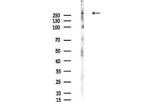 anti-Inositol 1,4,5,-Tris-Phosphate Receptor (ITP-R83A) (pSer1598) antibody