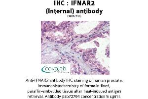 Image no. 2 for anti-Interferon alpha/beta Receptor 2 (IFNAR2) (Internal Region) antibody (ABIN1735773) (IFNAR2 antibody  (Internal Region))
