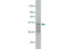 Western Blot detection against Immunogen (37. (CDKL5 antibody  (AA 722-831))