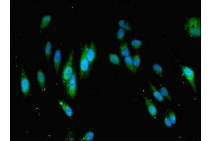 Immunofluorescent analysis of Hela cells using ABIN7160136 at dilution of 1:100 and Alexa Fluor 488-congugated AffiniPure Goat Anti-Rabbit IgG(H+L) (MOCS2 antibody  (Catalytic Subunit))