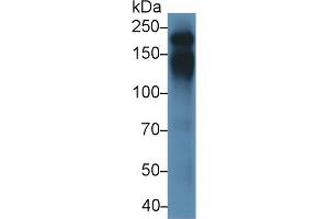 Detection of CD45 in Mouse Thymus lysate using Polyclonal Antibody to Protein Tyrosine Phosphatase Receptor Type C (CD45) (CD45 antibody  (AA 371-556))